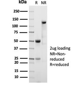 SDS-PAGE Analysis of Purified ALDH1A1 Recombinant Rabbit Monoclonal (ALDH1A1/7011R). Confirmation of Integrity and Purity of Antibody.