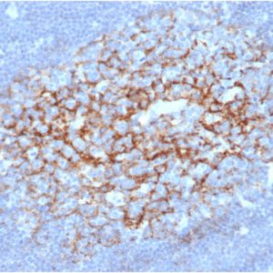 IHC analysis of formalin-fixed, paraffin-embedded human lymph node. Membrane stained using FCER2/6892 at 2ug/ml in PBS for 30min RT. HIER: Tris/EDTA, pH9.0, 45min. 2 °: HRP-polymer, 30min. DAB, 5min.