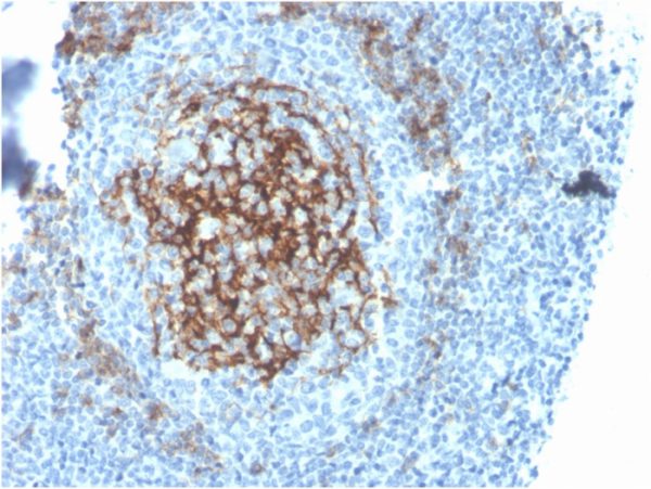 Formalin-fixed, paraffin-embedded human tonsil stained with CD23 Recombinant Rabbit Monoclonal Antibody (FCER2/4395R).