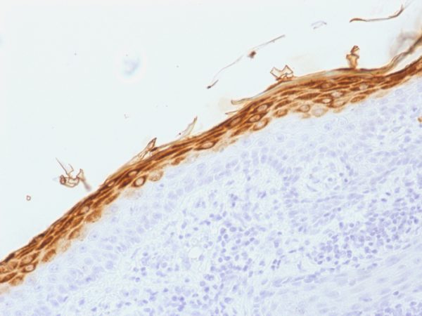 Formalin-fixed, paraffin-embedded human Skin stained with Filaggrin Mouse Monoclonal Antibody (FLG/1562).