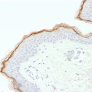 Formalin-fixed, paraffin-embedded human skin stained with Biotin-conjugated FilaggrinMouse Monoclonal Antibody(FLG/1563).