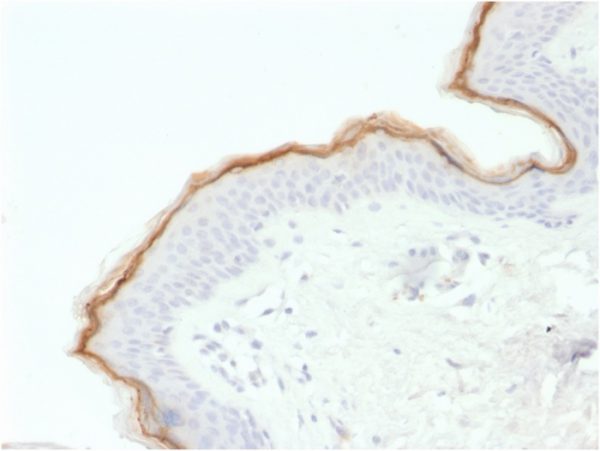 Formalin-fixed, paraffin-embedded human skin stained with Biotin-conjugated FilaggrinMouse Monoclonal Antibody(FLG/1563).
