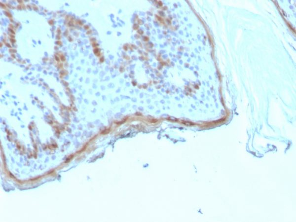 Formalin-fixed, paraffin-embedded human skin stained with Filaggrin Recombinant Mouse Monoclonal Antibody (rFLG/1945).