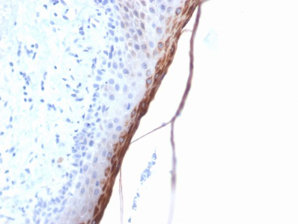 Formalin-fixed, paraffin-embedded human Skin stained with Filaggrin Rabbit Recombinant Monoclonal Antibody (FLG/1957R).