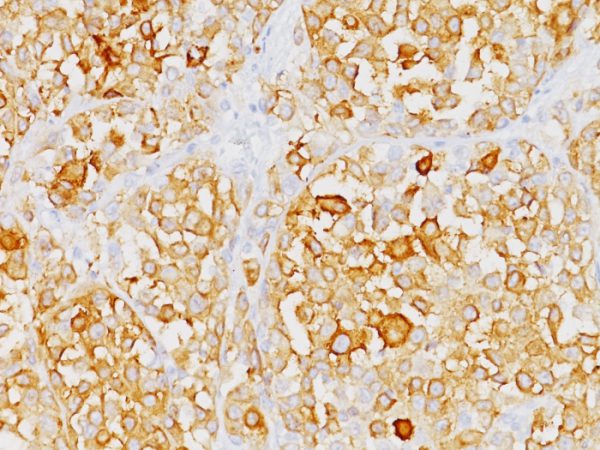 MART-1 / Melan-A / MLANA (Melanoma Marker) Antibody - Image 2