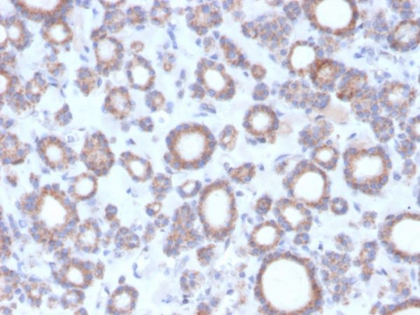 Formalin-fixed, paraffin-embedded human thyroid stained with DBC2 Mouse Monoclonal Antibody (DBC2/3364).