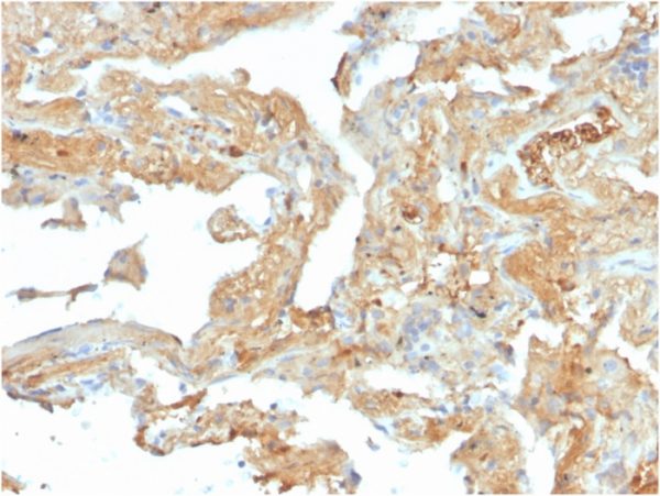 Formalin-fixed, paraffin-embedded human lung stained with Fibronectin Mouse Monoclonal Antibody (FN1/2950).