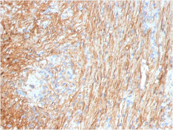 Formalin-fixed, paraffin-embedded human lung stained with Fibronectin Mouse Monoclonal Antibody (FN1/3036).