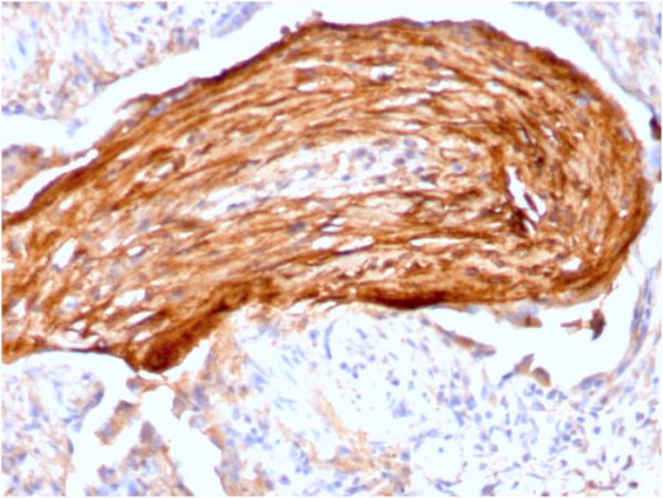 Formalin-fixed, paraffin-embedded human lung stained with Fibronectin Mouse Monoclonal Antibody (FN1/3045).