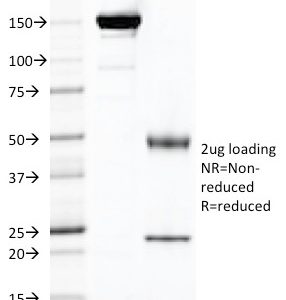 SDS-PAGE Analysis of Purified FOLH1 Mouse Monoclonal Antibody (FOLH1/2121). Confirmation of Purity and Integrity of Antibody.