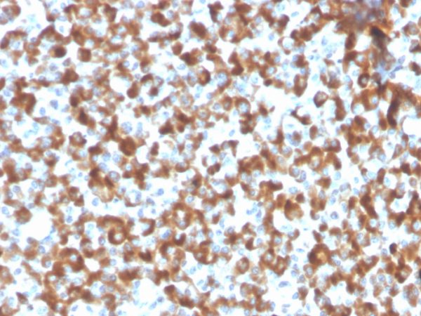 Formalin-fixed, paraffin-embedded human pituitary tissue stained with FSH beta Recombinant Rabbit Monoclonal Antibody (FSHb/2033R).