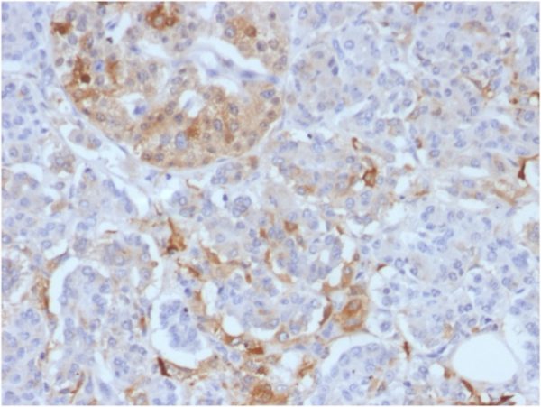 Formalin-fixed, paraffin-embedded human Pancreas stained with Ferritin, Light Chain Monoclonal Antibody (FTL/1388).