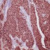 Recombinant GATA-3 (Breast and Urothelial Marker) Antibody - Image 2