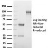 GATA-3 (Center) (Breast and Urothelial Marker) Antibody - Image 2