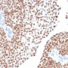 GATA-3 (Center) (Breast and Urothelial Marker) Antibody - Image 4