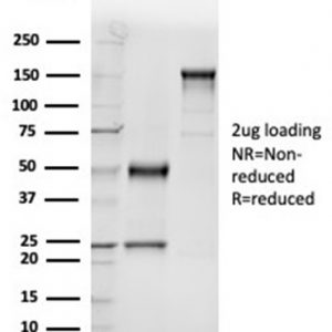 SDS-PAGE Analysis of Purified GC Mouse Monoclonal Antibody (VDBP/4481). Confirmation of Purity and Integrity of Antibody.