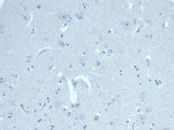 IHC analysis of formalin-fixed, paraffin-embedded human cerebral cortex. Negative tissue control using AMH/6713R at 2ug/ml in PBS for 30min RT. HIER: Tris/EDTA, pH9.0, 45min. 2°C: HRP-polymer, 30min. DAB, 5min.