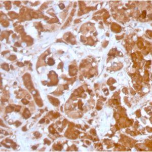 Formalin-fixed, paraffin-embedded human Pituitary stained with Growth Hormone Mouse Monoclonal Antibody (GH/3155).