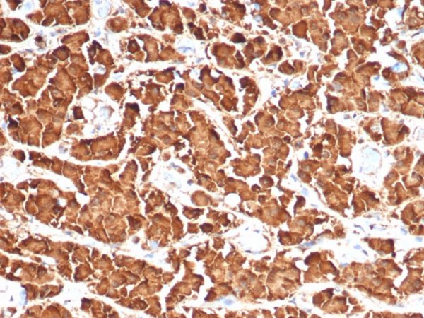 Formalin-fixed, paraffin-embedded human pituitary stained with Growth Hormone Recombinant Rabbit Monoclonal Antibody (GH/4886R).