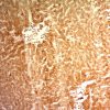 Glypican-3 (GPC3) (Hepatocellular Carcinoma Marker) Antibody