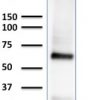 Glypican-3 (GPC3) (Hepatocellular Carcinoma Marker) Antibody - Image 2