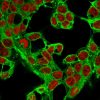 Glypican-3 (GPC3) (Hepatocellular Carcinoma Marker) Antibody - Image 3