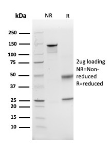 SDS-PAGE Analysis of Purified GCLM Mouse Monoclonal Antibody (CPTC-GCLM-1). Confirmation of Integrity and Purity of Antibody.