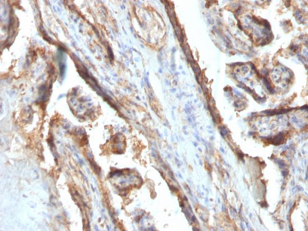 Formalin-fixed, paraffin-embedded human Placenta stained with Galectin-13 Monoclonal Antibody (PP13/1161).