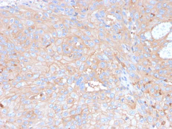 Formalin-fixed, paraffin-embedded human skin stained with PD-L1 Recombinant Mouse Monoclonal Antibody (rPDL1/4773).