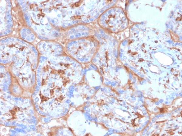 Formalin-fixed, paraffin-embedded human placenta stained with PD-L1 Recombinant Mouse Monoclonal Antibody (rPDL1/4773).