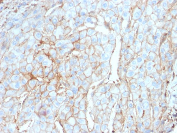 PDL1 Antibody in Immunohistochemistry (IHC (P))