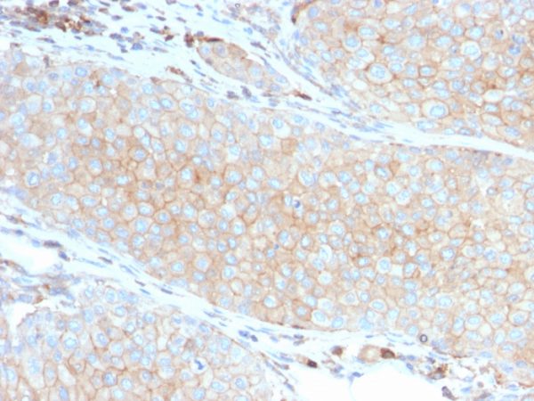 PDL1 Antibody in Immunohistochemistry (IHC (P))