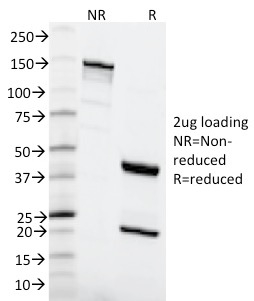 SDS-PAGE Analysis of Purified MSH6 Mouse Monoclonal Antibody (MSH6/2111). Confirmation of Purity and Integrity.