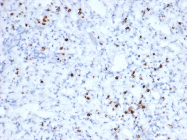 Formalin-fixed, paraffin-embedded human tonsil stained with Granzyme B Recombinant Mouse Monoclonal Antibody (rGZMB/6740).