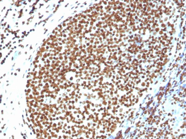 Formalin-fixed, paraffin-embedded human Tonsil stained with Histone H1 Rabbit Polyclonal Antibody.