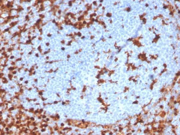 Recombinant Annexin A1 / (Hairy Cell Leukemia Marker) Antibody