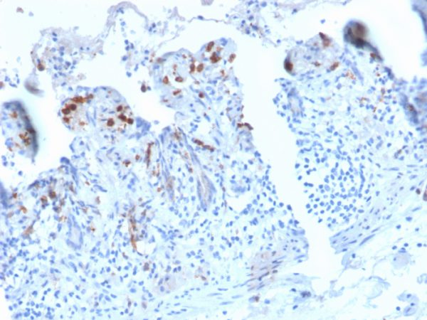 Formalin-fixed, paraffin-embedded human Small Intestine stained with CD209 Recombinant Rabbit Monoclonal Antibody (C209/2749R).