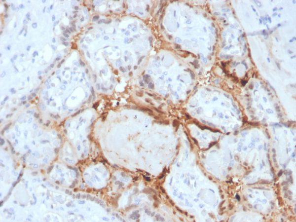 Formalin-fixed, paraffin-embedded human placenta stained with HIF1 alpha Mouse Monoclonal Antibody (Ha111a).