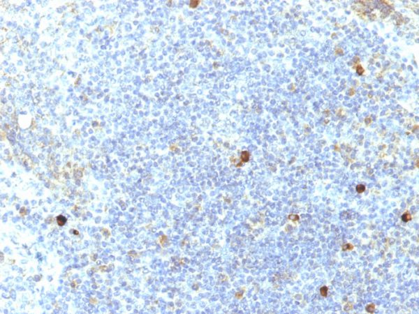 HLA-Aw32 & HLA-A25 (MHC I) Antibody