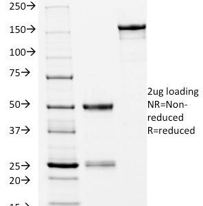 SDS-PAGE Analysis of Purified HLA-DRB Mouse Monoclonal Antibody (L243). Confirmation of Integrity and Purity of Antibody.