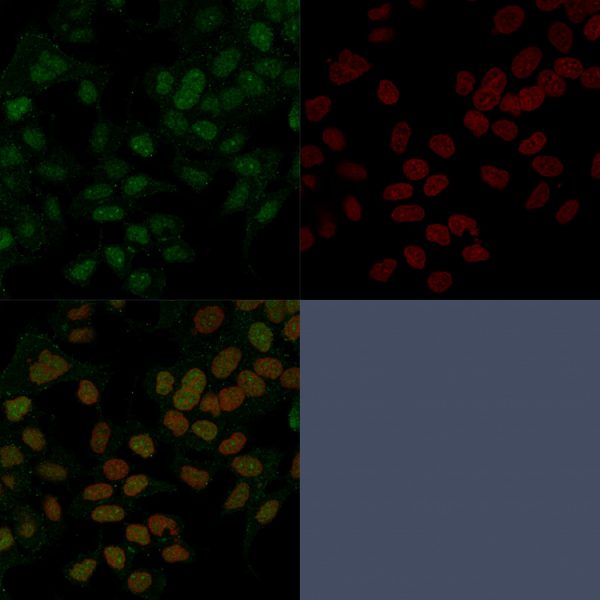 FOXA1 / HNF3A Antibody - Image 5