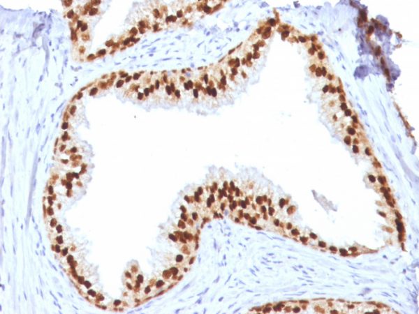 Formalin-fixed, paraffin-embedded human prostate stained with FOXA1 Mouse Monoclonal Antibody (FOXA1/1512).