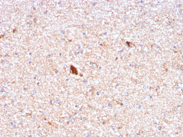 Formalin-fixed, paraffin-embedded human Brain stained with Serum Amyloid P Mouse Monoclonal Antibody (APCS/3240).