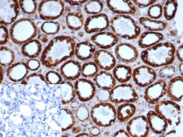 Formalin-fixed, paraffin-embedded human kidney stained with HSP60 Recombinant Mouse Monoclonal Antibody (rHSPD1/6497). Inset: 2°C Ab only control. Hematoxylin counterstain.