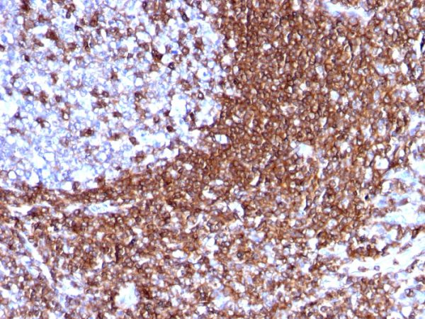 Formalin-fixed, paraffin-embedded human Tonsil stained with CD50 Mouse Monoclonal Antibody (186-2G9).