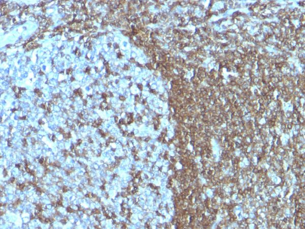 Formalin-fixed, paraffin-embedded human Tonsil stained with CD50 Monoclonal Antibody (SPM505)