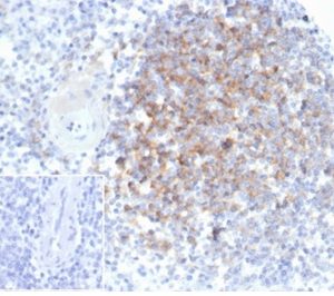 Formalin-fixed, paraffin-embedded human spleen stained with Interferon alpha 1 Mouse Monoclonal Antibody (IFNA/6689) at 2ug/ml. Inset: PBS instead of primary antibody; secondary only negative control