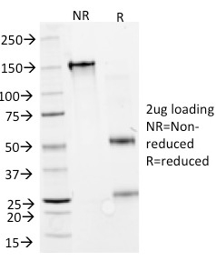 SDS-PAGE Analysis of Purified IFNA2 Mouse Monoclonal Antibody (N27). Confirmation of Purity and Integrity of Antibody.
