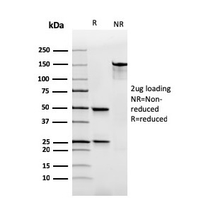 SDS-PAGE Analysis of Purified IgA Recombinant Mouse Monoclonal Antibody (rHISA43). Confirmation of Purity and Integrity of Antibody.