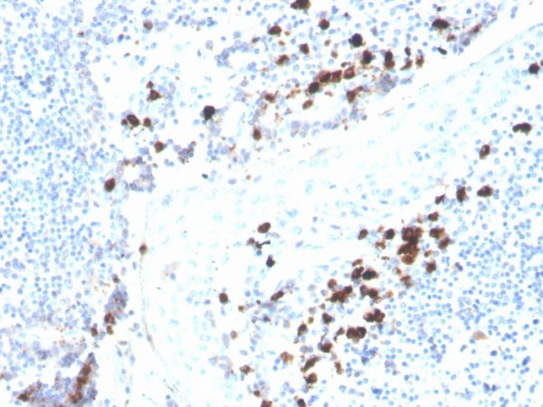 Formalin-fixed, paraffin-embedded human tonsil stained with IgA Recombinant Mouse Monoclonal Antibody (rHISA43).